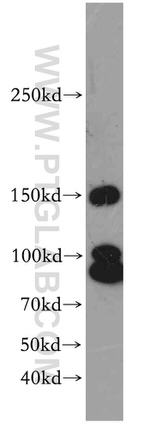 ROCK1 Antibody in Western Blot (WB)