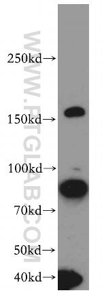 ROCK1 Antibody in Western Blot (WB)