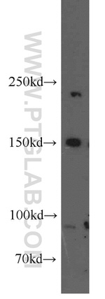 ROCK1 Antibody in Western Blot (WB)