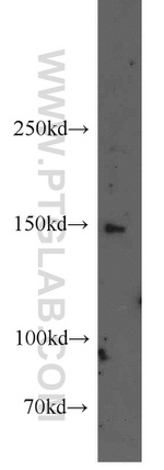 ROCK1 Antibody in Western Blot (WB)