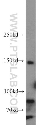 ROCK1 Antibody in Western Blot (WB)