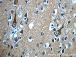 CPLX2 Antibody in Immunohistochemistry (Paraffin) (IHC (P))