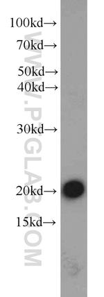 CPLX2 Antibody in Western Blot (WB)