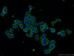 SCN9A/Nav1.7 Antibody in Immunocytochemistry (ICC/IF)