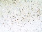 SCN9A/Nav1.7 Antibody in Immunohistochemistry (Paraffin) (IHC (P))