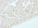 NSE gamma (Neuron Specific Enolase, gamma) (Neuroendocrine Marker) Antibody in Immunohistochemistry (Paraffin) (IHC (P))