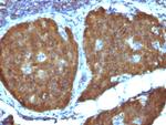 NSE gamma (Neuron Specific Enolase, gamma) (Neuroendocrine Marker) Antibody in Immunohistochemistry (Paraffin) (IHC (P))