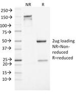 NSE gamma (Neuron Specific Enolase, gamma) (Neuroendocrine Marker) Antibody in SDS-PAGE (SDS-PAGE)
