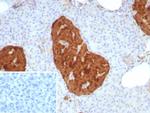 NSE gamma (Neuron Specific Enolase, gamma) (Neuroendocrine Marker) Recombinant Mouse Monoclonal Antibody (rENO/8857)