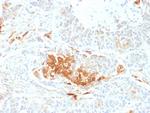 NSE gamma (Neuron Specific Enolase, gamma) Antibody in Immunohistochemistry (Paraffin) (IHC (P))