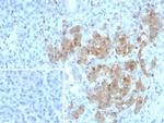 NSE gamma (Neuron Specific Enolase, gamma) (Neuroendocrine Marker) Recombinant Rabbit Monoclonal Antibody (ENO/8253R)