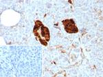 NSE gamma (Neuron Specific Enolase, gamma) (Neuroendocrine Marker) Recombinant Rabbit Monoclonal Antibody (ENO/8614R)