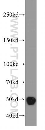 TAF1 Antibody in Western Blot (WB)