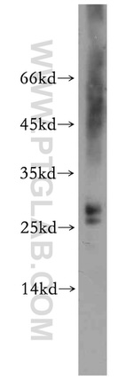 PPP1R11 Antibody in Western Blot (WB)