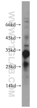 PPP1R11 Antibody in Western Blot (WB)