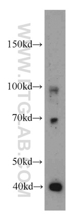 FOXH1 Antibody in Western Blot (WB)