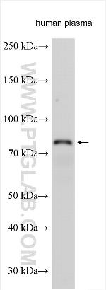 Factor XIIIb Antibody in Western Blot (WB)