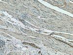 RREB1 Antibody in Immunohistochemistry (Paraffin) (IHC (P))