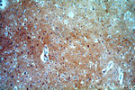 FAM127B Antibody in Immunohistochemistry (Paraffin) (IHC (P))