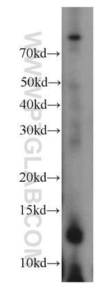 FAM127B Antibody in Western Blot (WB)