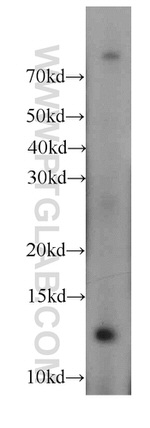 FAM127B Antibody in Western Blot (WB)