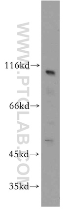 RADIL Antibody in Western Blot (WB)