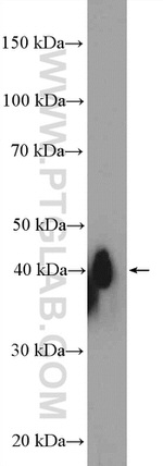 XRCC2 Antibody in Western Blot (WB)