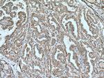 ALG3 Antibody in Immunohistochemistry (Paraffin) (IHC (P))
