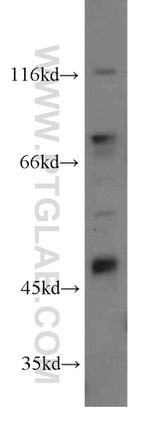 MLN64 Antibody in Western Blot (WB)