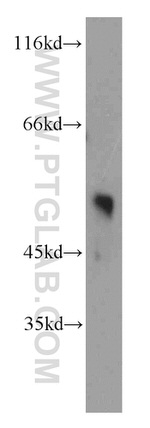MLN64 Antibody in Western Blot (WB)
