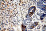 MLN64 Antibody in Immunohistochemistry (Paraffin) (IHC (P))