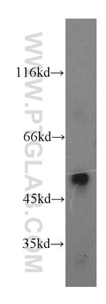 MLN64 Antibody in Western Blot (WB)
