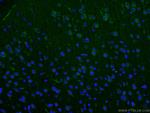 SLC6A8 Antibody in Immunohistochemistry (PFA fixed) (IHC (PFA))