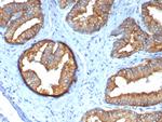 Tubulin, beta Antibody in Immunohistochemistry (Paraffin) (IHC (P))