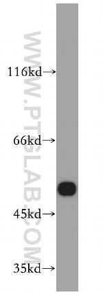 DRD5 Antibody in Western Blot (WB)