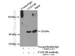 CLEC3B Antibody in Immunoprecipitation (IP)