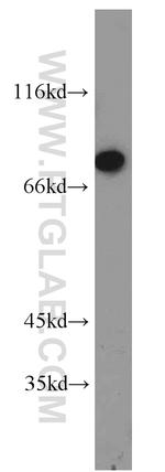 GBE1 Antibody in Western Blot (WB)