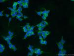 CLN6 Antibody in Immunocytochemistry (ICC/IF)