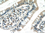 CLN6 Antibody in Immunohistochemistry (Paraffin) (IHC (P))