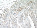 CLN6 Antibody in Immunohistochemistry (Paraffin) (IHC (P))