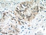 CLN6 Antibody in Immunohistochemistry (Paraffin) (IHC (P))