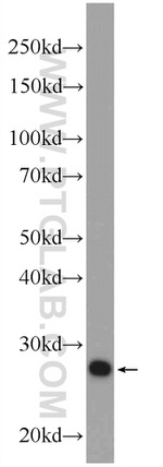 CLN6 Antibody in Western Blot (WB)