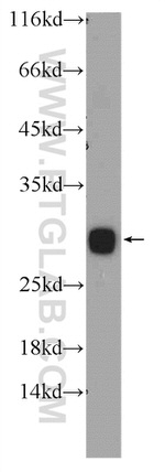CLN6 Antibody in Western Blot (WB)