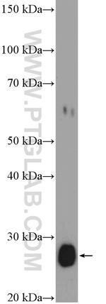 CLN6 Antibody in Western Blot (WB)
