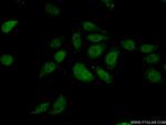 TIAF1 Antibody in Immunocytochemistry (ICC/IF)