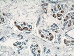 TIAF1 Antibody in Immunohistochemistry (Paraffin) (IHC (P))