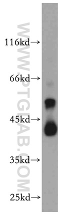 B4GALT2 Antibody in Western Blot (WB)
