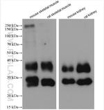 AQP1 Antibody in Western Blot (WB)