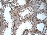 TADA1L Antibody in Immunohistochemistry (Paraffin) (IHC (P))