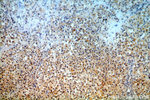 GPNMB Antibody in Immunohistochemistry (Paraffin) (IHC (P))